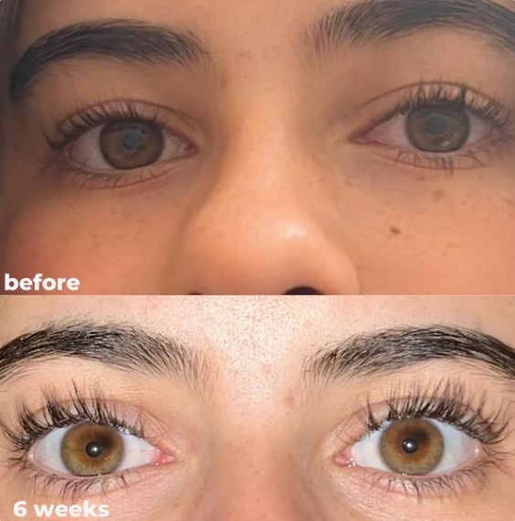 Serum para el crecimiento de pestañas